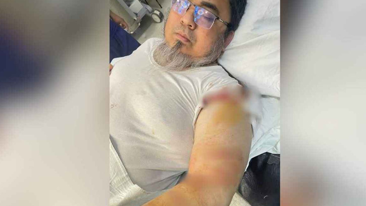 ডা. আহমদ হোসেনকে ছুরিকাঘাত: গ্রেফতার আরও দুই আসামি