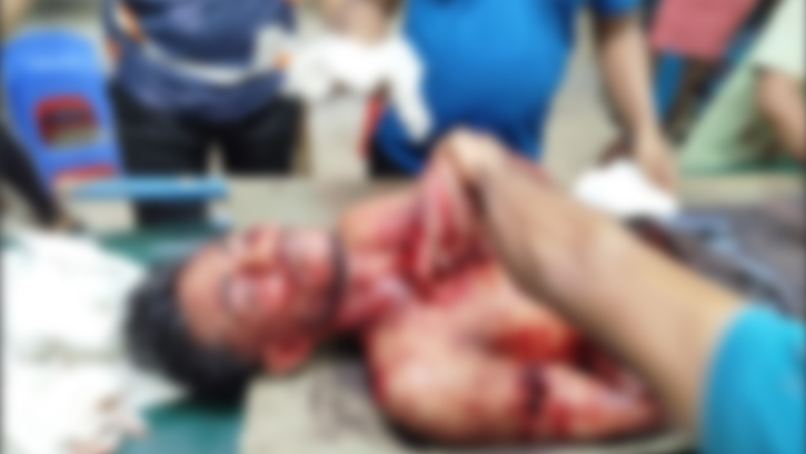 নোয়াখালীতে কিশোরকে কুপিয়ে হত্যা