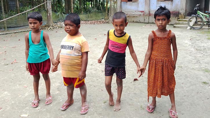 ভূরুঙ্গামারীতে ৩৩ বছরের ছমির এখনো শিশু