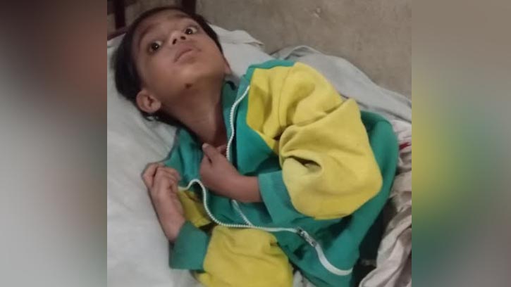 মোরেলগঞ্জে নাবালিকাকে শ্বাসরোধে হত্যাচেষ্টা, ইটের আঘাতে রক্তাক্ত শিশু