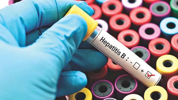 বিশ্বজুড়ে হেপাটাইটিস বি নিয়ন্ত্রণে এসেছে অগ্রগতি