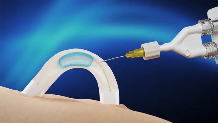 পুরুষদের জন্য নতুন জন্মনিরোধক ‘অ্যাডাম’