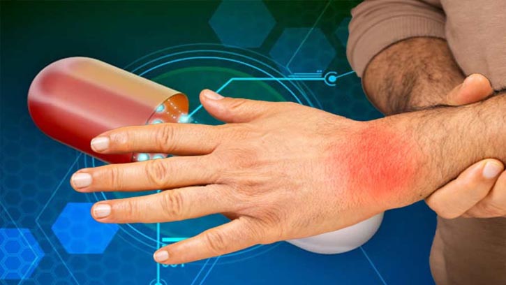 আর্থ্রাইটিস: ওষুধের সঙ্গে জীবনধারার পরিবর্তনই মূল চাবিকাঠি