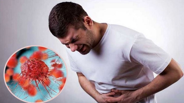 ক্যান্সারের প্রাথমিক লক্ষণ যা কখনোই উপেক্ষা করা যাবে না