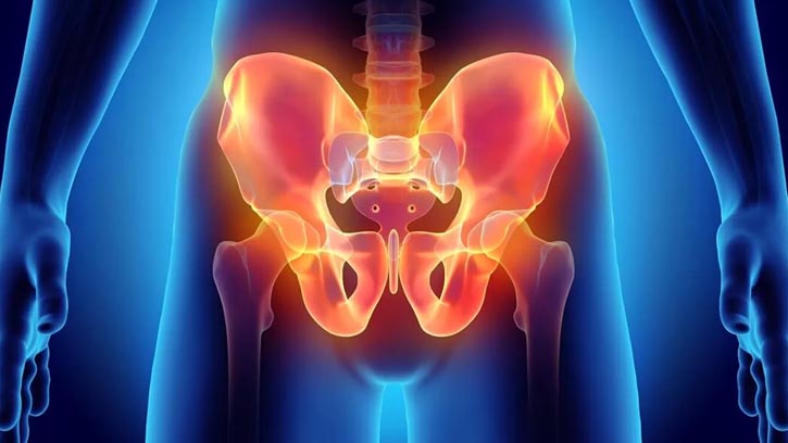 পুরুষদের পেলভিক ব্যথা: কারণ, লক্ষণ ও চিকিৎসা