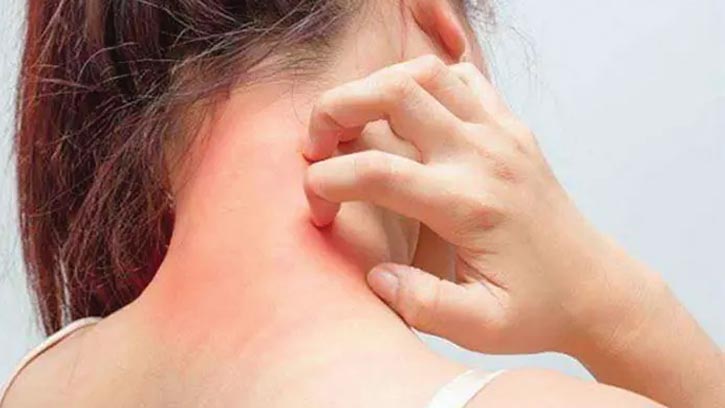 চুলকানি অবহেলা নয়! হতে পারে মারাত্মক রোগের লক্ষণ 