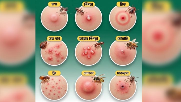 পোকা কামড়ের বিভিন্ন ধরন ও দাগ চেনার সহজ উপায়