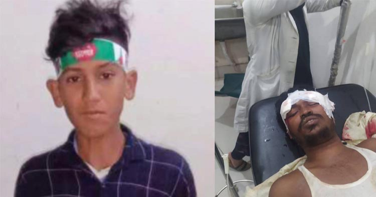 ফটিকছড়ি ভূজপুরে সড়ক দূর্ঘটনায় হতাহত ৩