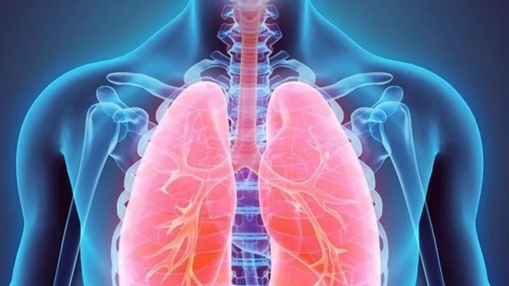 ফুসফুসের দীর্ঘমেয়াদি রোগ সিওপিডি: লক্ষণ ও সতর্কতা