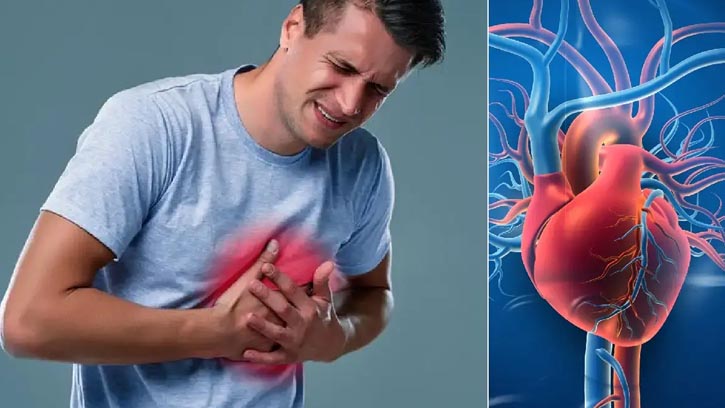 হার্ট অ্যাটাক ও স্ট্রোক এড়াতে ভিটামিন ডি জরুরি