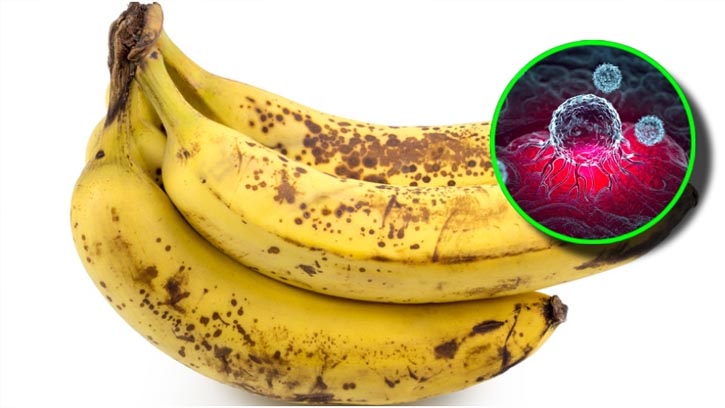 পাকা কলার দাগেই লুকিয়ে আছে ক্যানসার প্রতিরোধের শক্তি