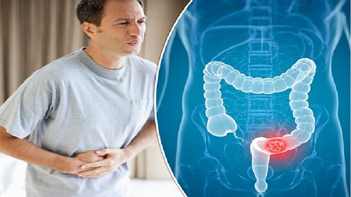 কোষ্ঠকাঠিন্য দূর করার ঘরোয়া উপায়