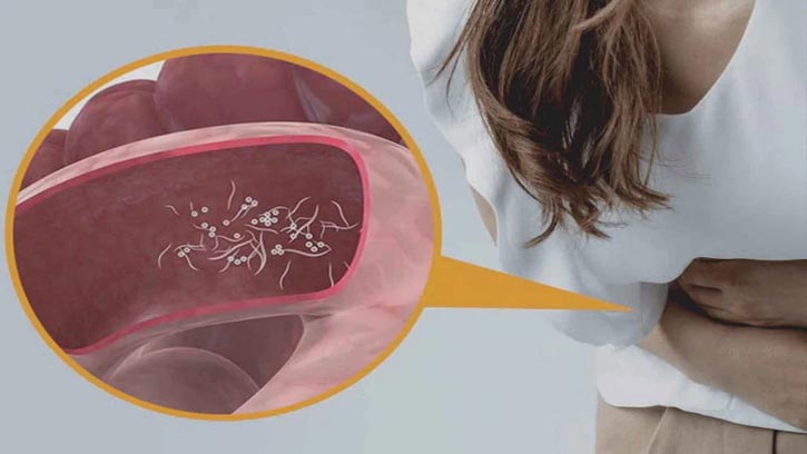 ৫ লক্ষণ দেখলে বুঝবেন শরীরে কৃমি বাসা বেঁধেছে