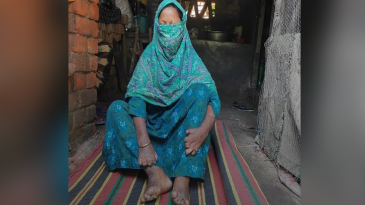 সাতক্ষীরায় কুষ্ঠরোগে বাড়ছে সচেতনতা, কমছে ভয়ের সংস্কার