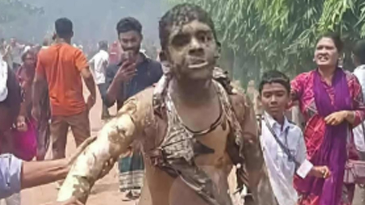 চামড়া ঝলসানো শরীরে দৌঁড়ানো ছেলেটি সন্দ্বীপের রোহান