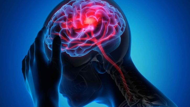 ৫০ বছরের কম বয়সী তরুণদের মধ্যে স্ট্রোকের আশঙ্কা বাড়ছে