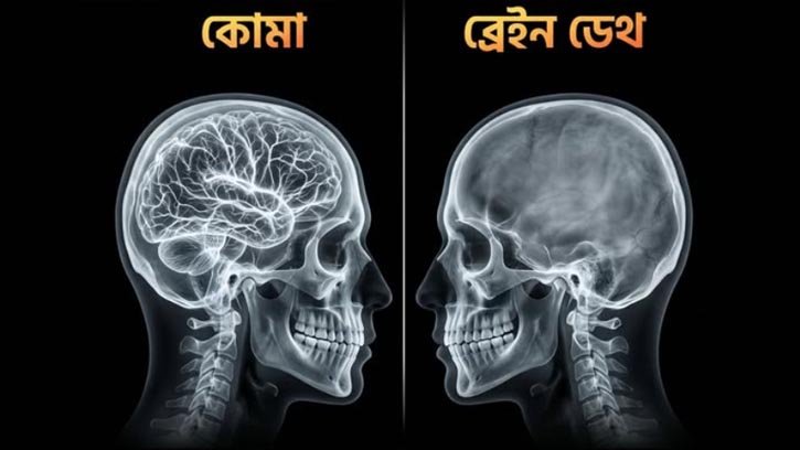 কোমা বনাম ব্রেইন ডেথ: চিকিৎসা বিজ্ঞানে জীবন ও মৃত্যুর সূক্ষ্ম রেখা