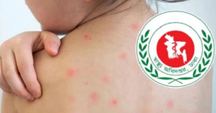 দেশজুড়ে হামের প্রকোপ বাড়ছে, ২৪ ঘণ্টায় আরও ৫ শিশুর মৃত্যু