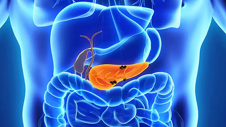 পেটের সমস্যার আড়ালে প্যানক্রিয়াসের গোপন ঝুঁকি!